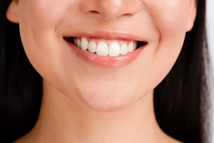 Berkumur Air Garam Bisa Memutihkan Gigi, Benarkah?